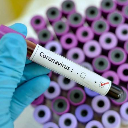 U RS-u preminulo još šest pacijenata koji su bili zaraženi koronavirusom