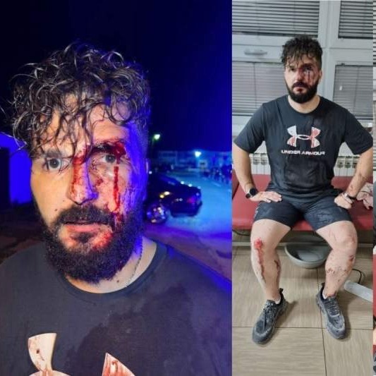 Novinar Mirza Dervišević iz Brčkog u sačekuši napadnut i pretučen