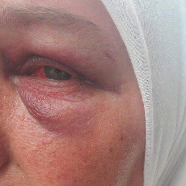Atak zbog hidžaba |Šest mjeseci zatvora za divljački napad na Jasminu Kurtu i njenu kćerku