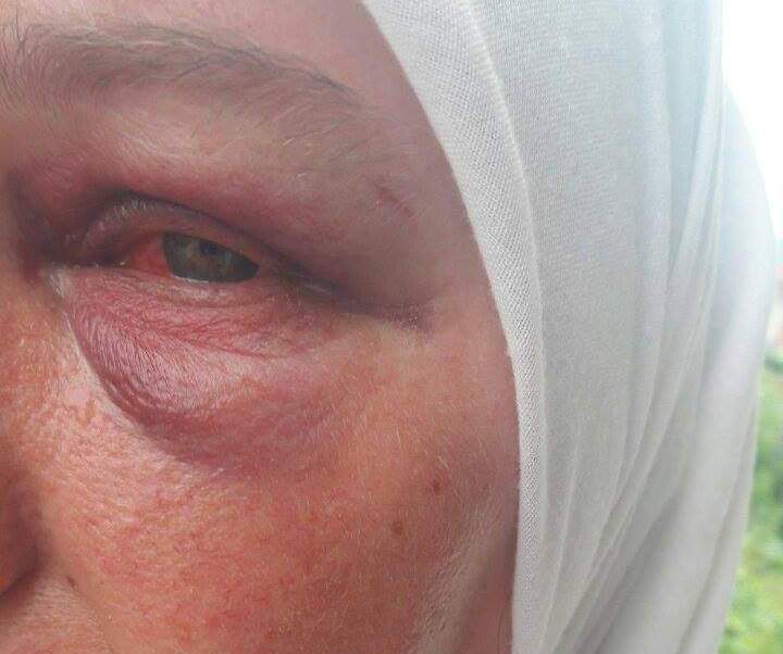 Atak zbog hidžaba |Šest mjeseci zatvora za divljački napad na Jasminu Kurtu i njenu kćerku