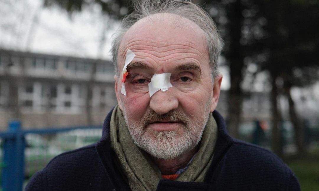 Nedžad Latić otkrio ko ga je napao: Bio je to pokušaj ubistva